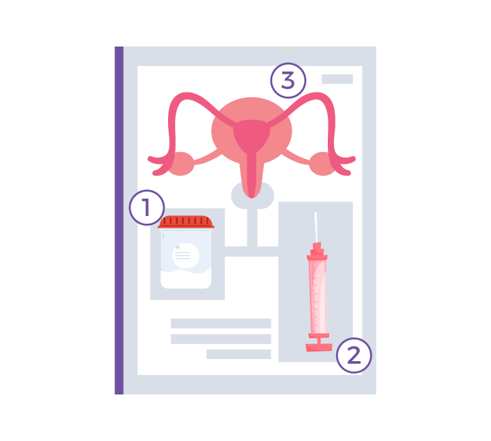 Png header articolo-L’inseminazione intrauterina